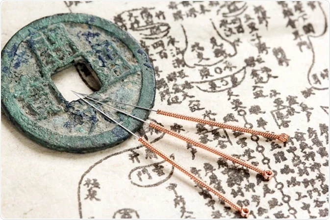 Acupuncture needles with ancient model and coin